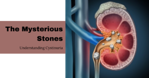 The Mysteious Stones