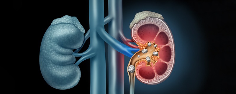 Everything You Need to Know About Kidney Infections - VNH