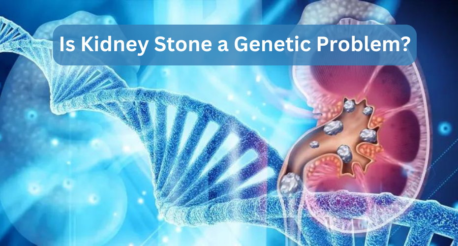 Kidney Stone Genetic Problem