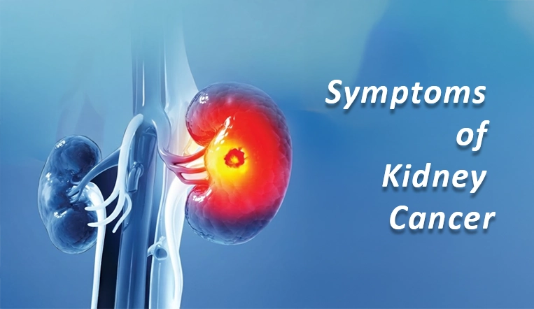 Symtoms of Kidney Cancer
