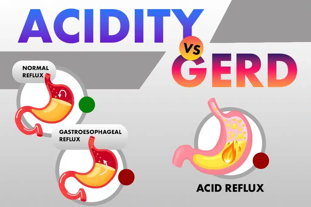 Acidity Gred