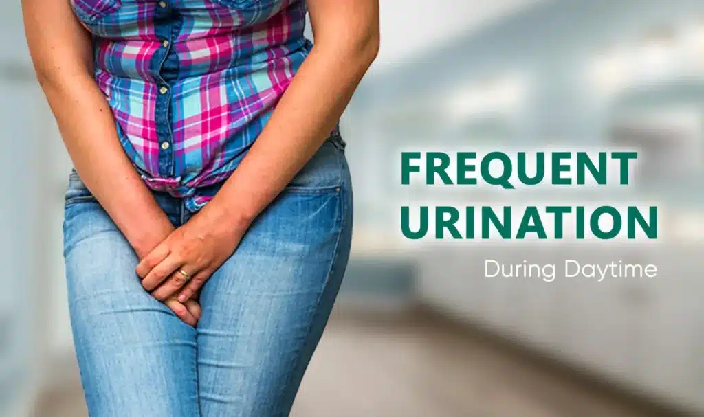 Frequent Urination During the Day