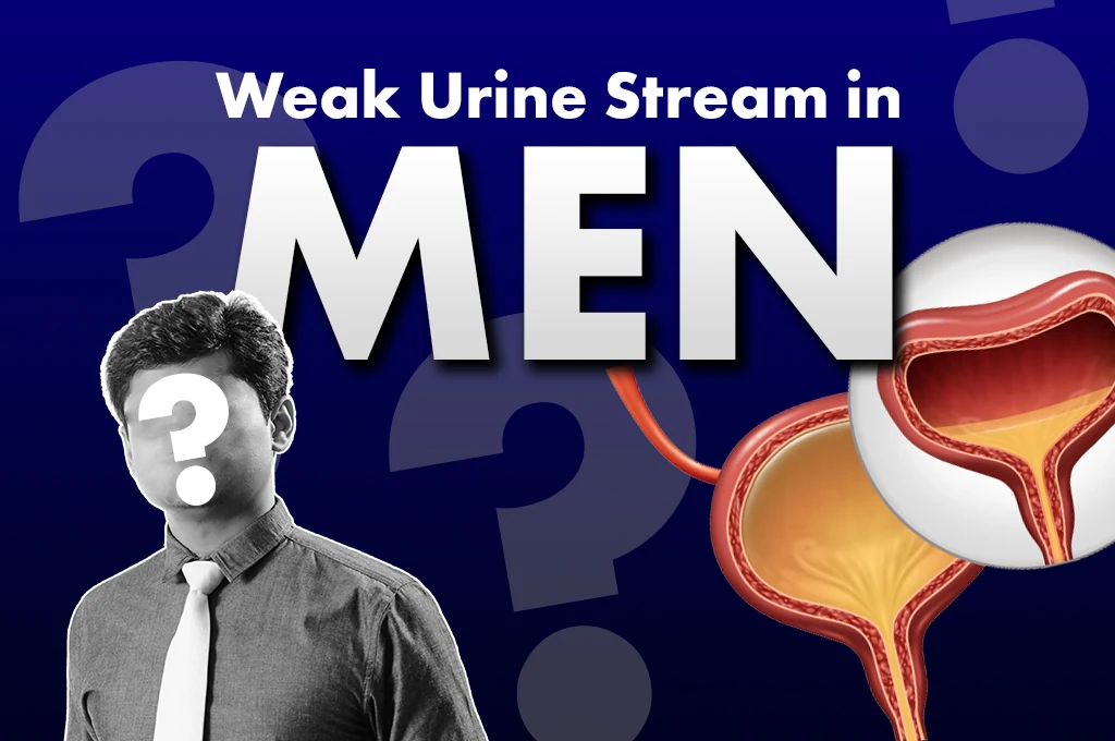 Weak Urine Stream in Men