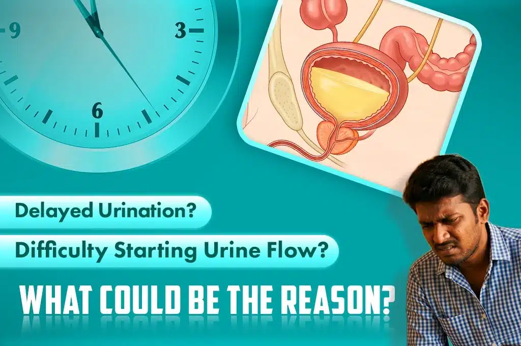 Difficulty Starting Urine Flow